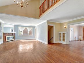 155 N Downing Street, Denver CO 80218