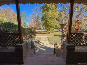 155 N Downing Street, Denver CO 80218