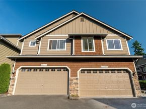 20409 25th Place W, Lynnwood WA 98036