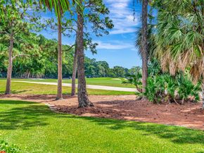 11 Berwick Road NE, Palm Beach Gardens FL 33418