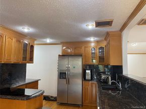 988 Westwood Road, Woodmere NY 11598