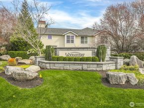 6523 188th Place NE, Redmond WA 98052